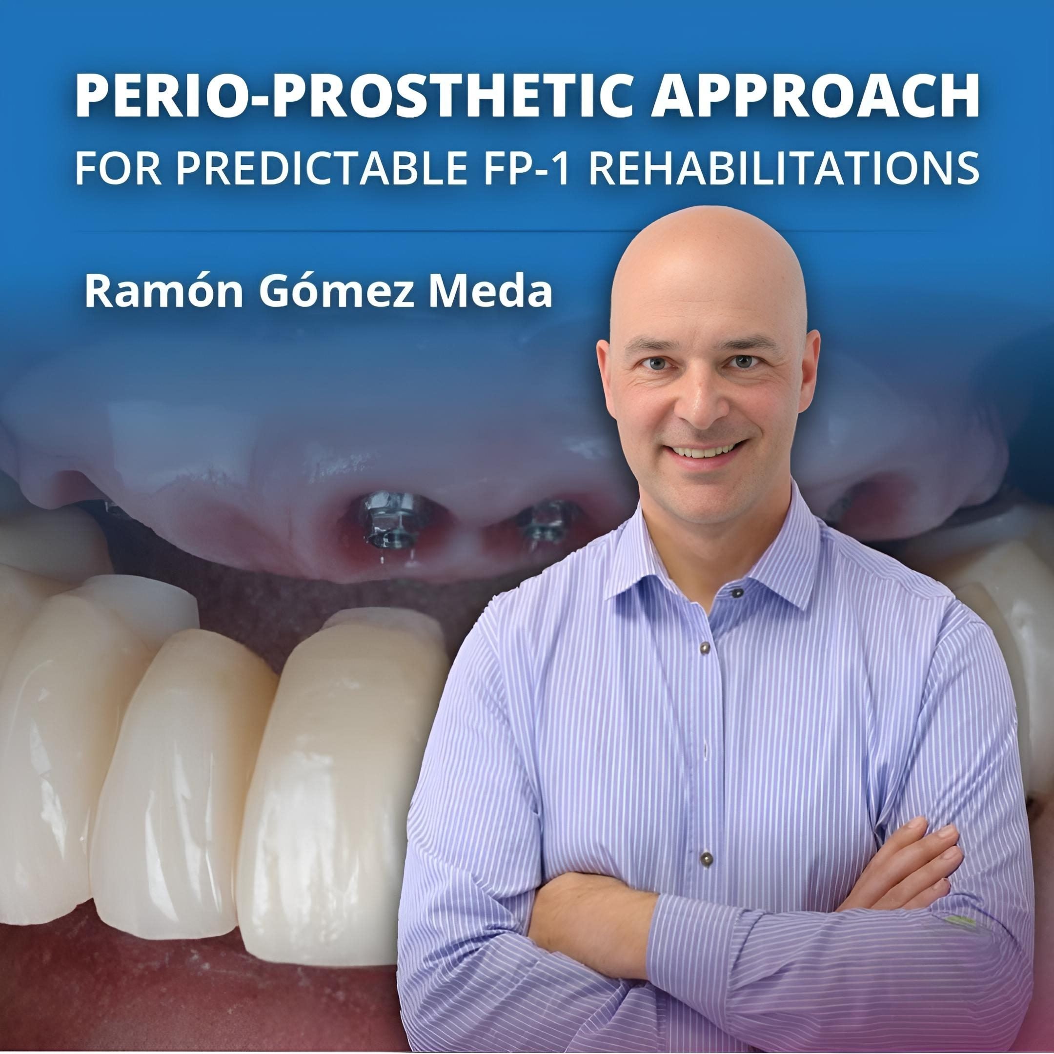 Perio-Prosthetic Approach for FP-1 Rehabilitations