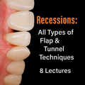 Recessions: All Types of Flap &amp; Tunnel Techniques